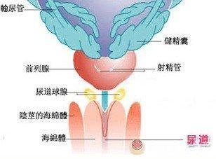 苏州男性淋病容易引起哪些疾病