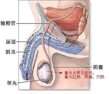 睾丸炎造成的危害有哪些