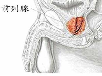 哪些人易患前列腺痛