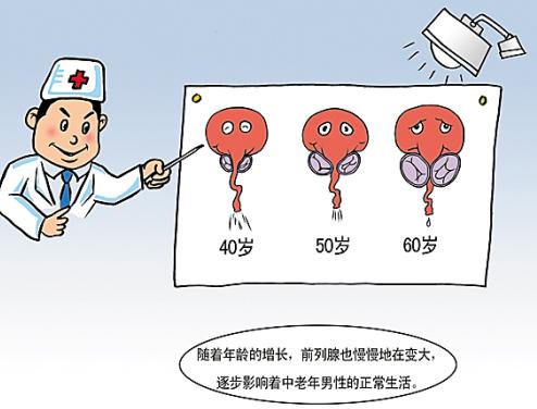 前列腺增生的检查项目