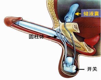 苏州男科医院哪家好，勃起功能障碍是怎么引起的？