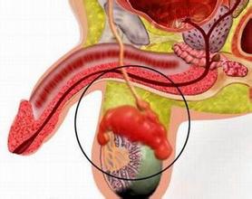 石河子男科医院介绍前列腺囊肿有哪些？