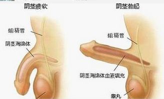 苏州性功能障碍专业医院