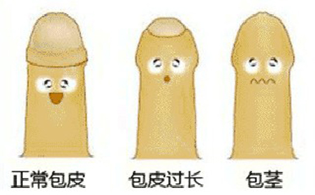 新乡包皮手术哪里好