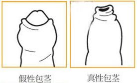 苏州做包皮手术哪家医院好