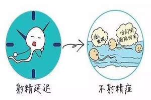 苏州哪里治疗精液不液化