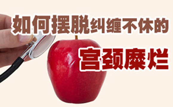 医生谈造成宫颈糜烂原因