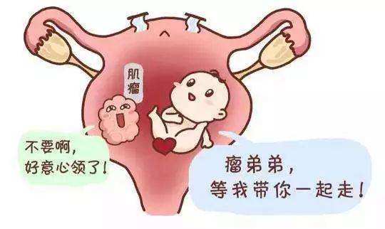 苏州妇科保健医院_子宫肌瘤会导致不孕吗