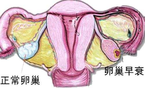 苏州妇科有什么好医院_导致女性卵巢早衰的原因