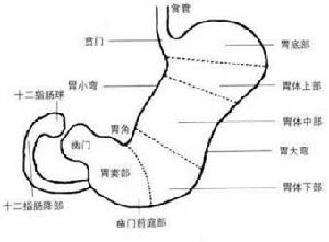 糜烂性胃炎的症状