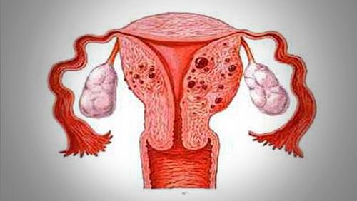 苏州治疗子宫肌腺症医院