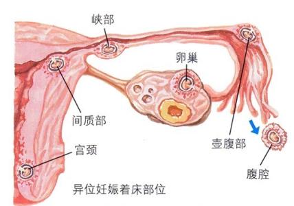 苏州治疗排卵障碍医院